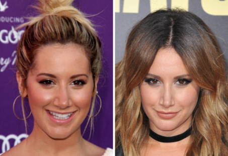 6 Famous Celebrity Nose Jobs