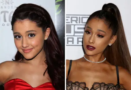 Ariana Grande brow lift and eyelid before and after