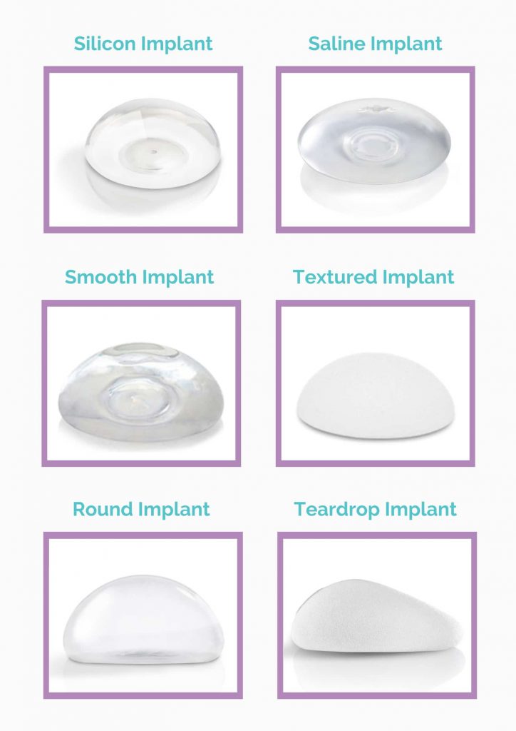 Types of Implants