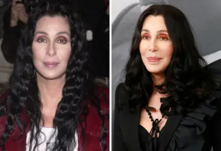 Cher Plastic Surgery: How The Goddess Of Pop Changed
