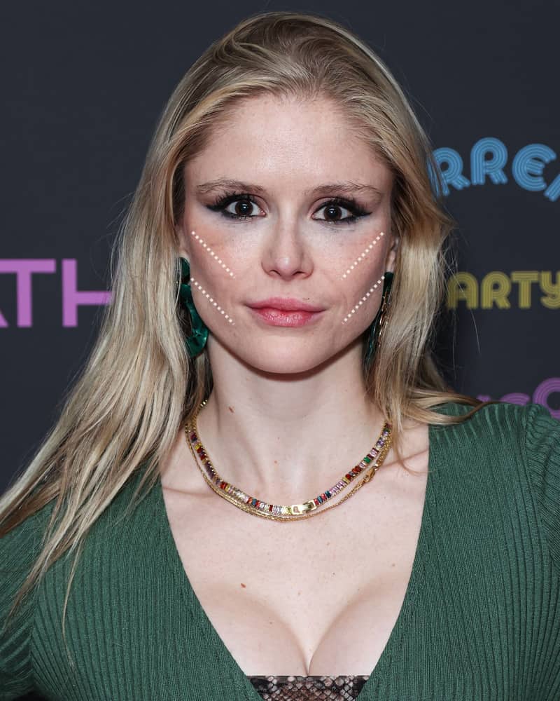 erin moriarty buccal fat removal