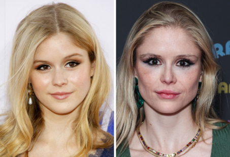 erin-moriarty-plastic-surgery.jpg