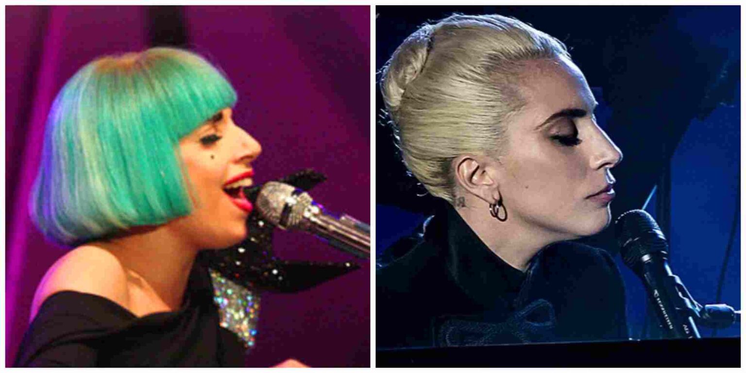 lady gaga plastic surgery Image 6