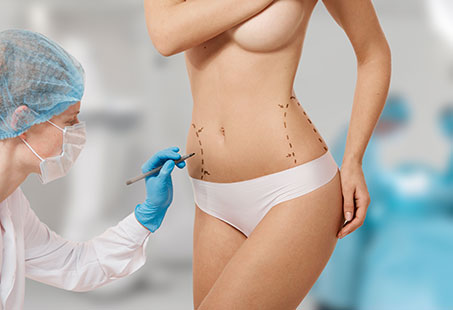 360 liposuction