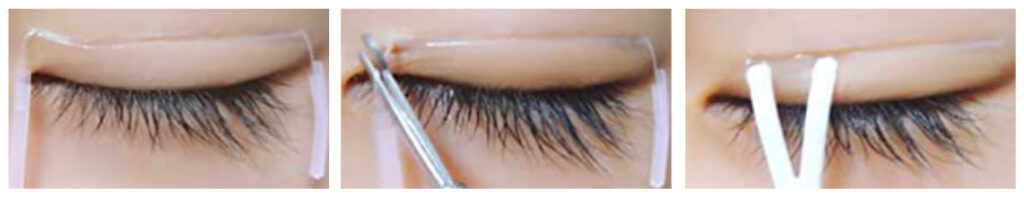 Nonsurgical double eyelid tape