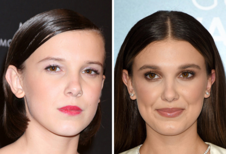 millie bobby brown fillers