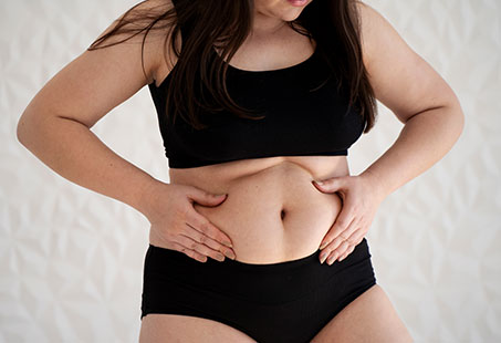reverse tummy tuck