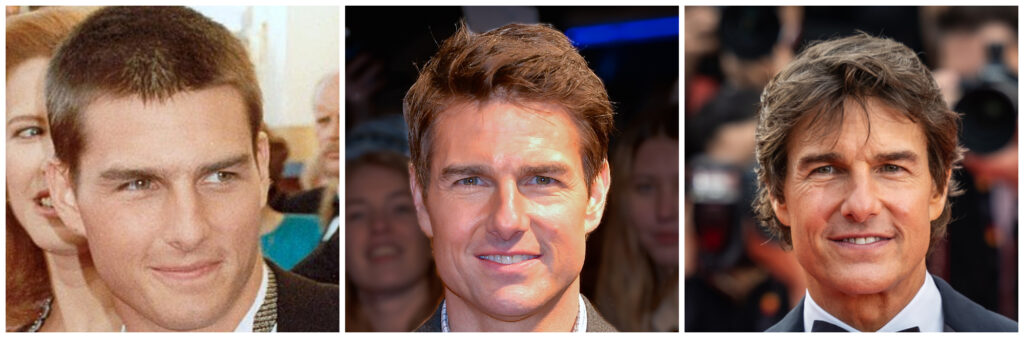 Tom Cruise face before and after