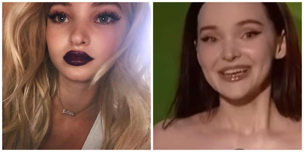 Dove Cameron nose before and after