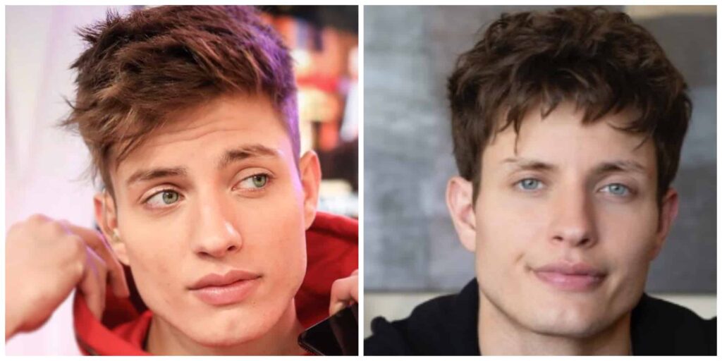 Matt Rife before and after 1