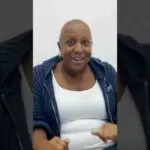 kays hair transplant journey in .jpg