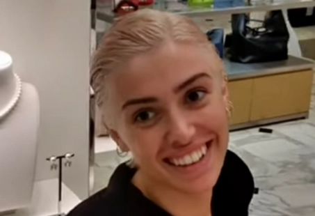 Plastic Surgeon Reveals Bianca Censori's Worth $70K Surgeries