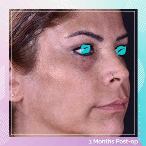 face patient 1 after