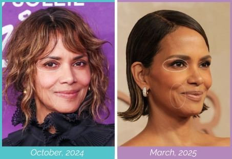Plastic Surgery Or Diet? Expert Weighs In On Halle Berry At 58
