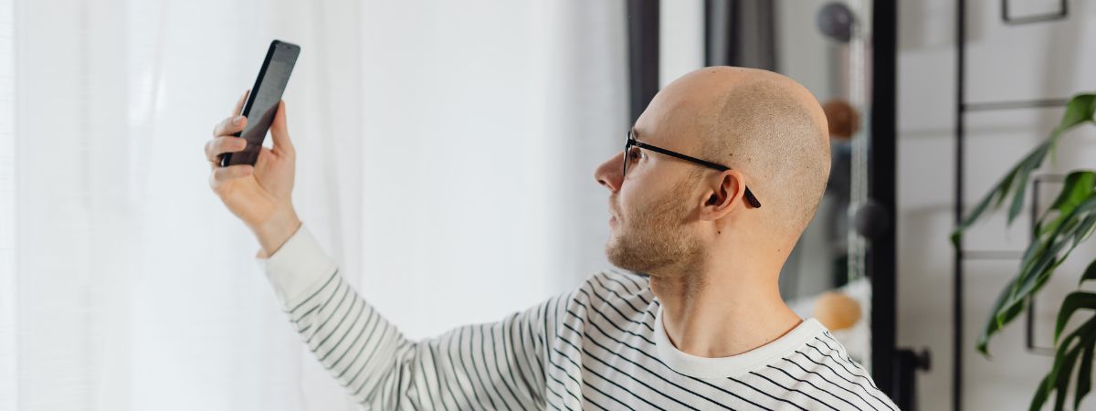 share your scalp photos for hair transplant turkey