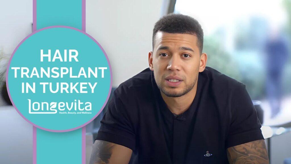 Simon Searles Sharing His Hair Transplant Experience in Turkey
