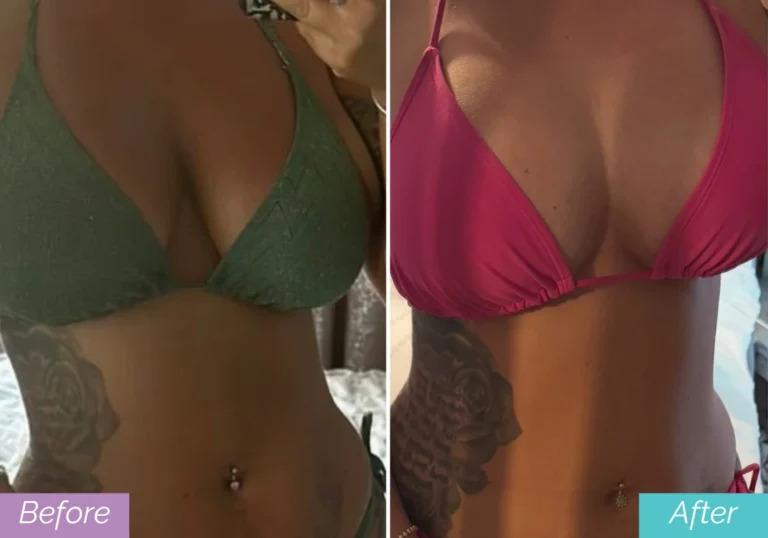 Jade before & after longevita