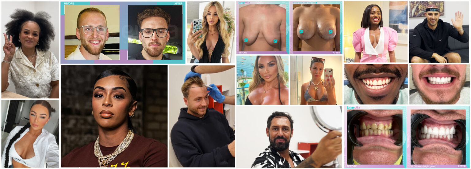 Collage of Longevita patient transformations including hair transplants, cosmetic surgery results, and dental smile makeovers.