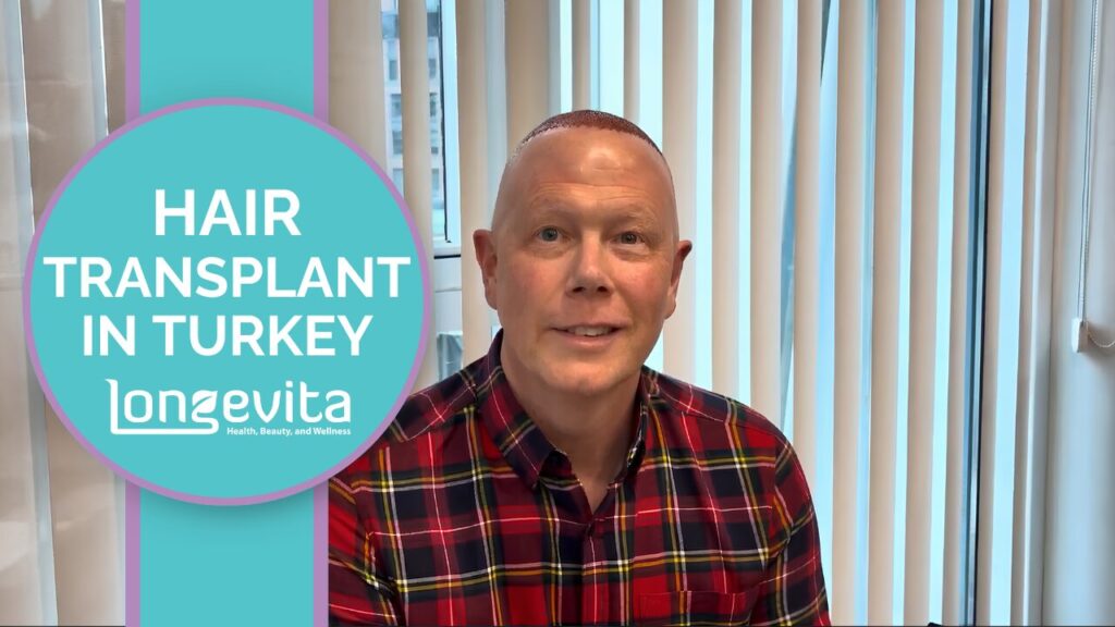 Craig's hair transplant Turkey