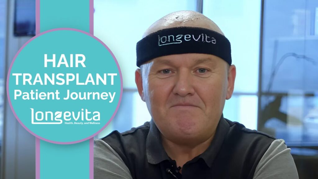 James West Hair Transplant patient journey