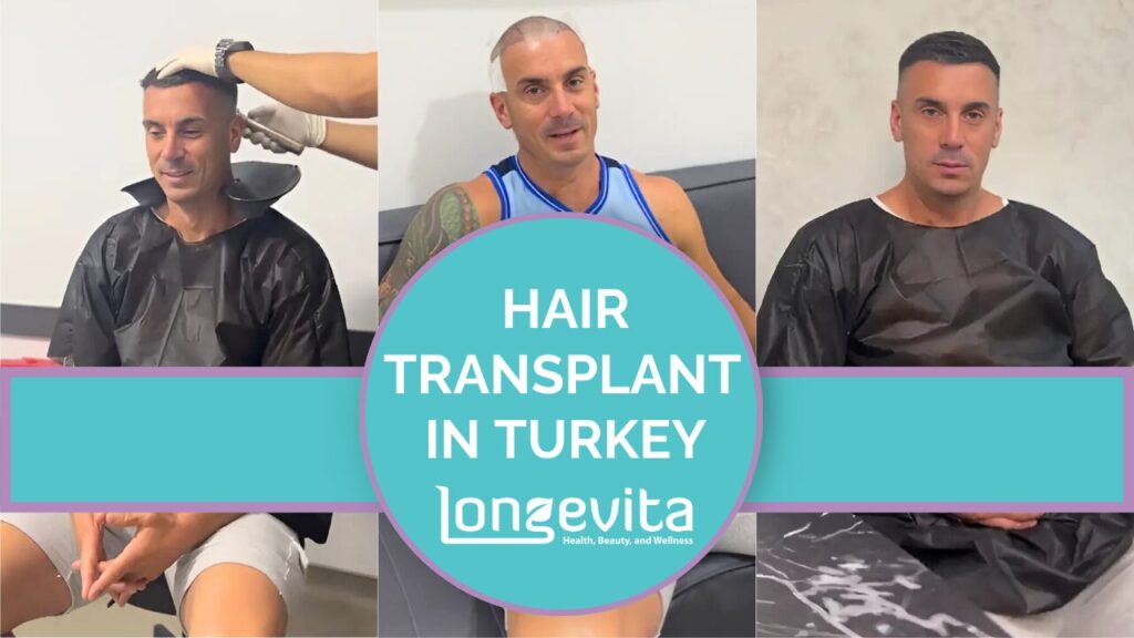 Gareth's hair transplant journey in Turkey
