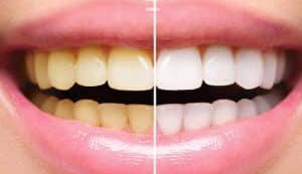 cosmetic dentistry.jpg