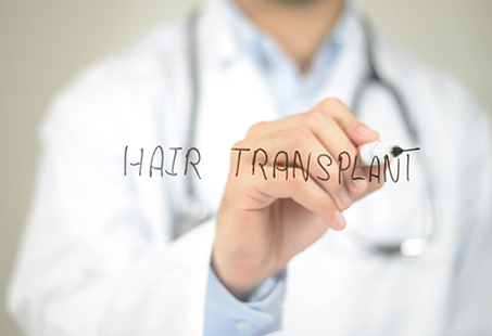 how long do hair transplants last