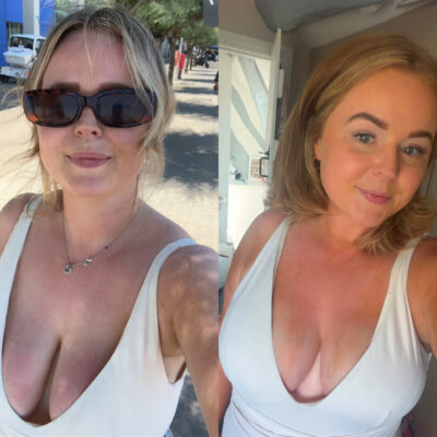 Chloe before and after 1