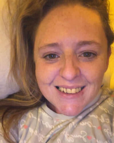 Gillian before treatment